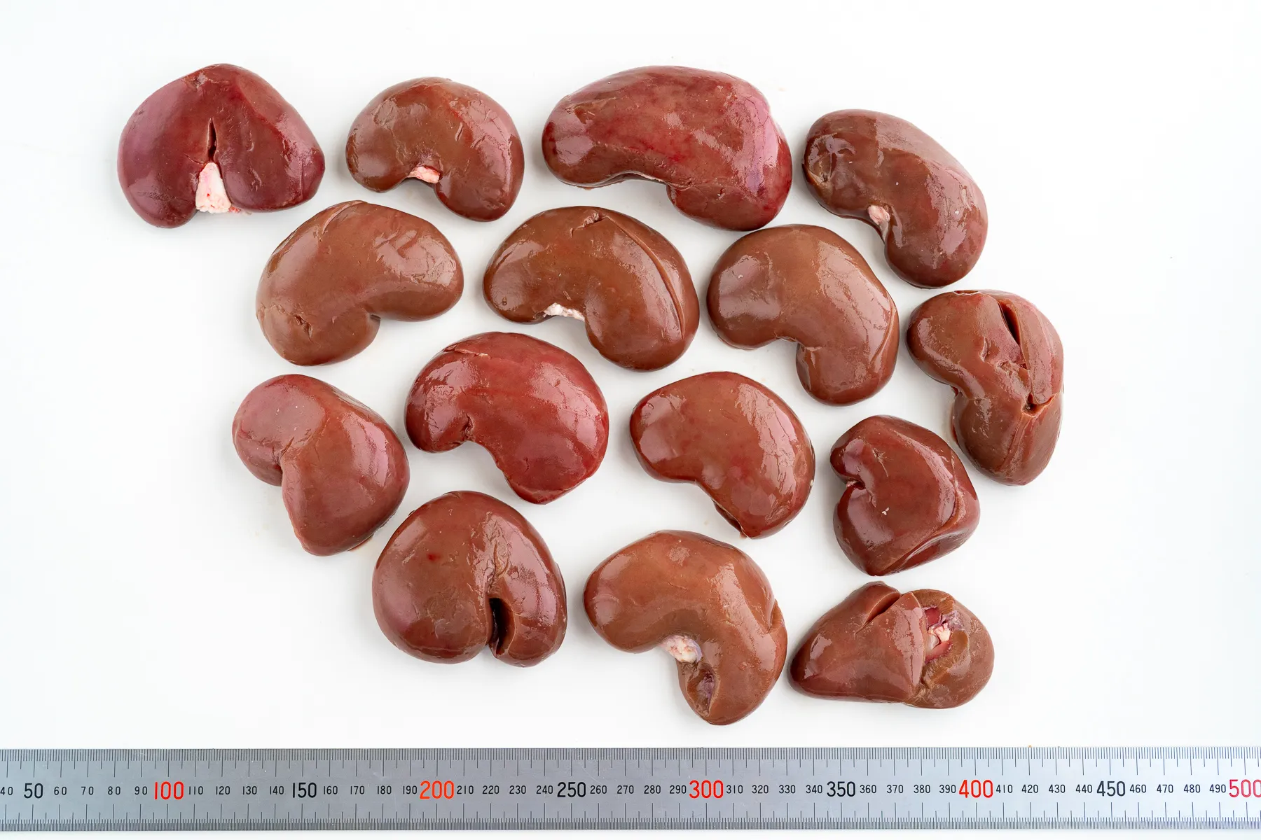腎臓